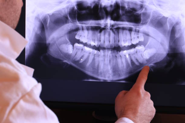 Best Emergency Treatment for Dental Infections or Abscesses in North Gates, NY